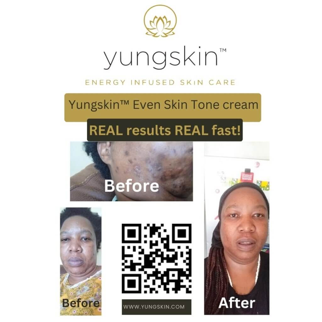 Yungskin™-Even-Skin-Tone-cream-Website-Popup